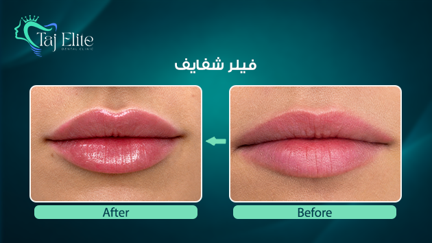 before-^-after17 (1)